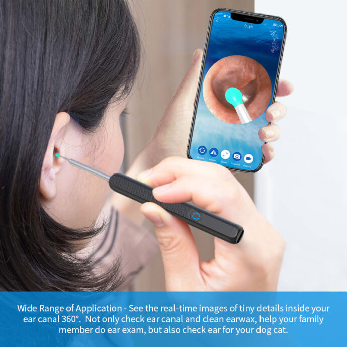 ⁦Kit de nettoyage des oreilles intelligents sans fil avec caméra et lumière LED NE3⁩ - الصورة ⁦6⁩