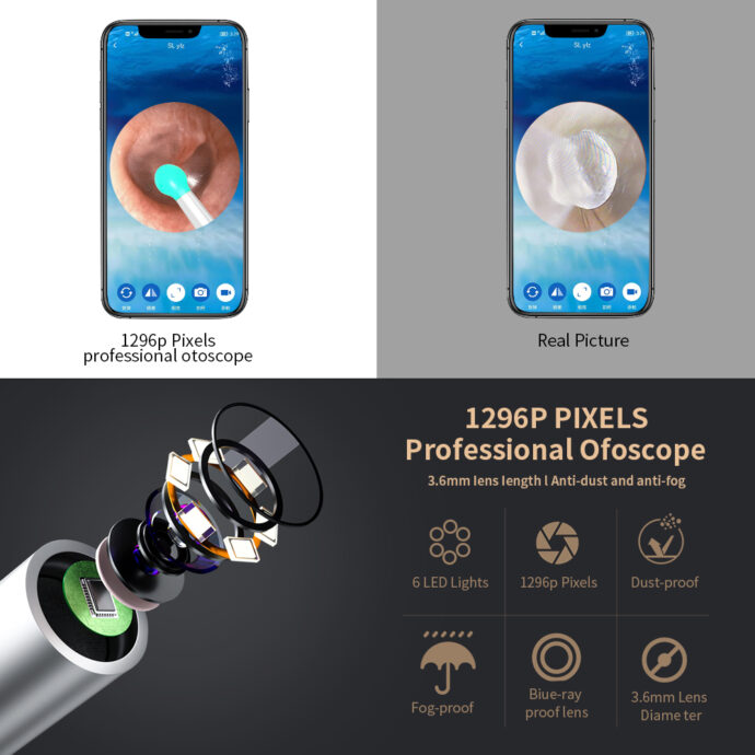 ⁦Kit de nettoyage des oreilles intelligents sans fil avec caméra et lumière LED NE3⁩ - الصورة ⁦7⁩